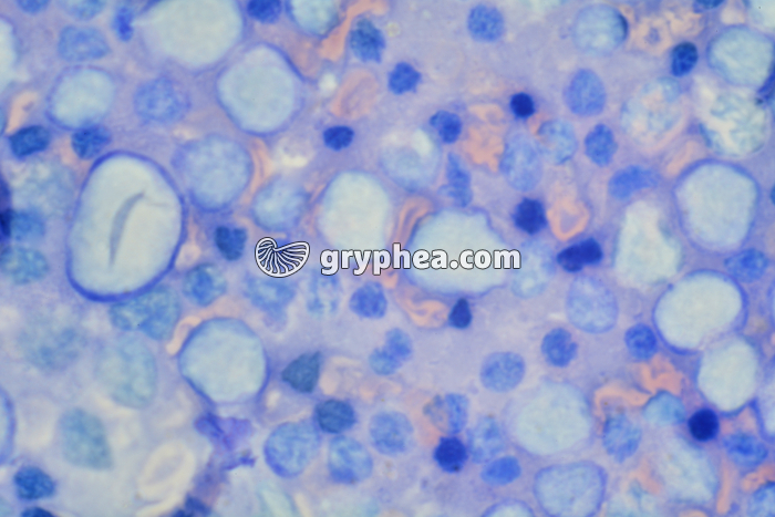 Macrophages du liquide péritonéal x400 - gryphea.org